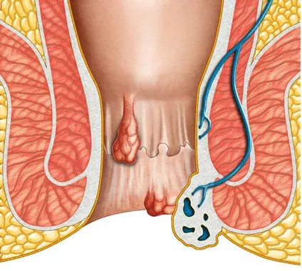 Doctors Safety Glasses