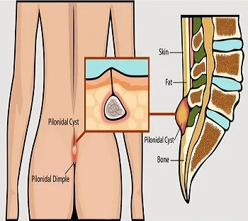 Patients Safety Glasses