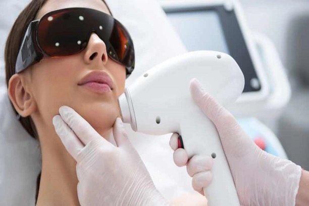 Underarm laser treatment